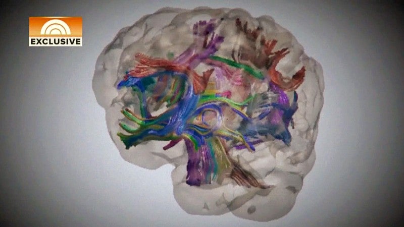 a 3D model of a brain with brightly colored neural pathways