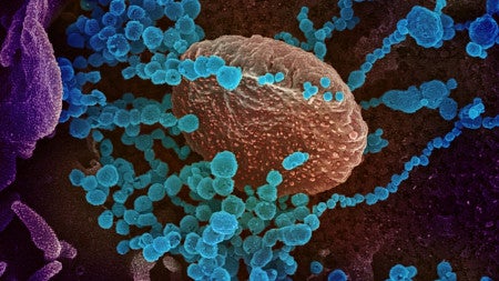 Image of the coronavirus through a microscope. 